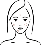 Pigmentation